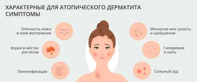 Подкожные прыщи: как избавиться, причины появления закрытых комедонов на  коже, препараты от заболевания, лечение акне и угревой сыпи