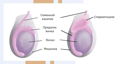 Цистит у мужчин: признаки, симптомы, причины заболевания, лечение