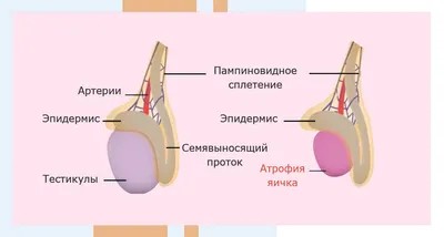 Атрофия яичек - признаки,причины, диагностика и лечение уменьшения яичек -  АльтраВита