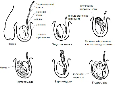 Заболевания мужских органов фото