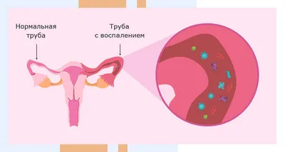 Генитальный герпес на половых органах у мужчин и женщин, лечение, симптомы