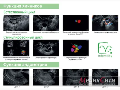 Зуд наружных половых органов (вульвы) у женщин • MedOK медичний центр  Вінниця | Бар