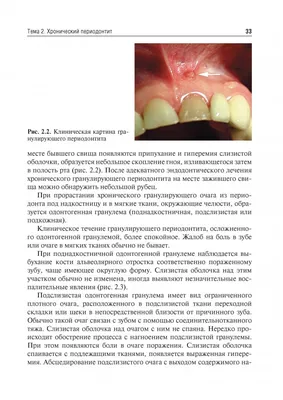 Причины заболевания полости рта, виды заболеваний