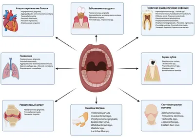 Грибковые заболевания полости рта | Remedium.ru