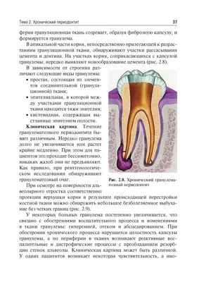 Заболевания слизистой полости рта: виды и особенности лечения