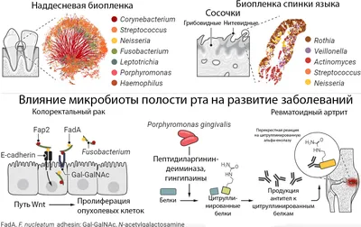 Британские учёные: Плохая гигиена полости рта на 75% повышает риск рака  печени | Все о печени | Дзен