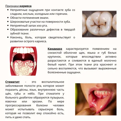 Заболевания слизистой оболочки полости рта