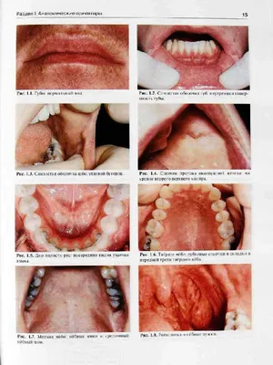 Заболевания слизистой оболочки полости рта и губ (б/у). (ID#175693918),  цена: 685 ₴, купить на Prom.ua