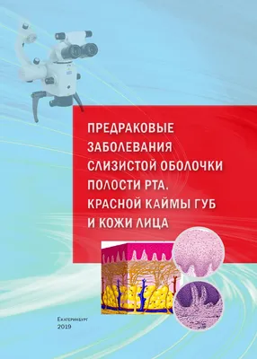 Иллюстрация 9 из 21 для Одонтогенные воспалительные заболевания полости рта.  Учебное пособие - Базикян, Бычков, Гончаров | Лабиринт - книги. Источник:  Лабиринт