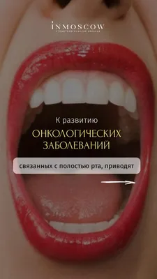 Что делать при появлении молочницы во рту | Стоматология Smile-at-Once |  Дзен