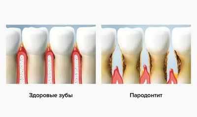 Средства и методы гигиены полости рта. Как ухаживать за полостью рта