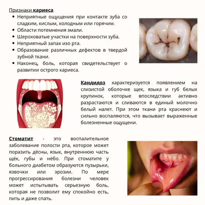 Гингивит у детей (воспаление десны у ребенка) – как лечить