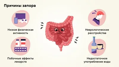 Запор Анатомии Запоры Симптомы Проблема Стул Движение Кишечника Кишечник  Прямой стоковое фото ©lightsource 610342748