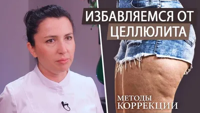 Целлюлит. ТОП-5 процедур против целлюлита