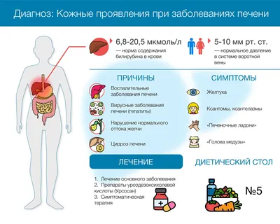 Симптомы застоя лимфы. 4 простых способа борьбы с застоем лимфы