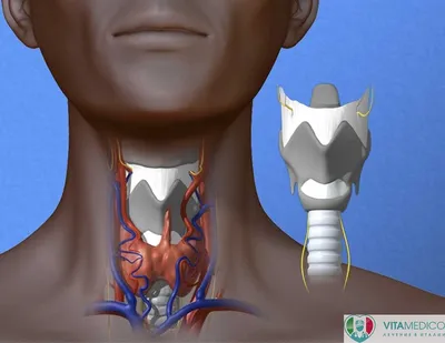 Голосовая реабилитация больных с односторонними парезами гортани после  хирургического лечения рака щитовидной железы | Чойнзонов | Проблемы  Эндокринологии