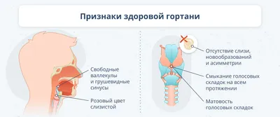 Внезапный стеноз гортани | Пикабу