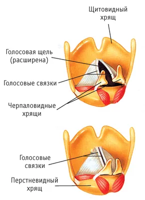 Рак горла – диагностика, лечение, удаление новообразований в Москве