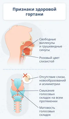 КТ мягких тканей шеи и гортани, что показывает, подготовка - mrt24spb.ru