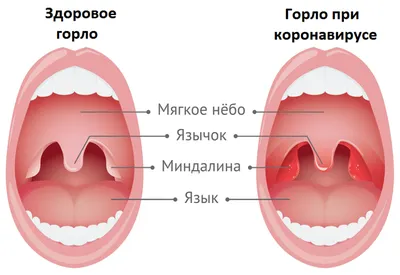 Чем лечить горло ребенку — блог Фурасол®