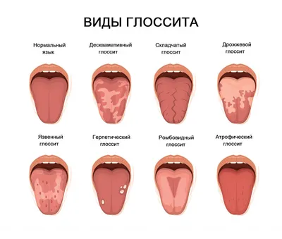 Здоровый язык стоковое фото. изображение насчитывающей регистр - 30725172