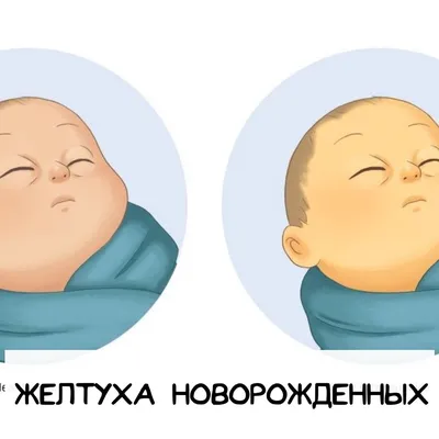 Механическая желтуха лечение