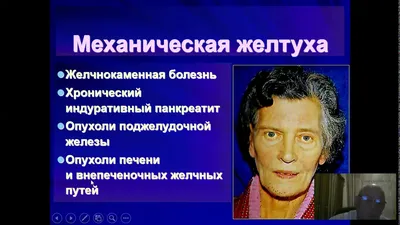 Послеродовая желтуха у новорожденных: особенности и лечение — Медицинский  центр «Целитель»