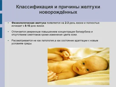 Желтуха грудного молока - Информационный центр