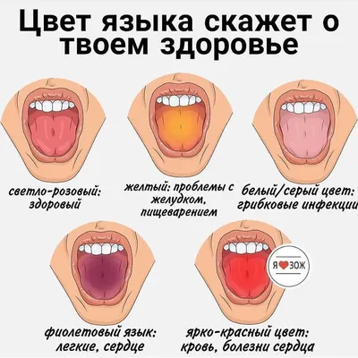 Налет на языке: нужно ли паниковать, к кому обратиться за лечением — D.Ante