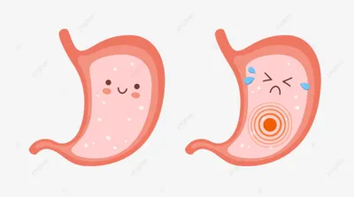 Синдром ленивого желудка - Гастроцентр