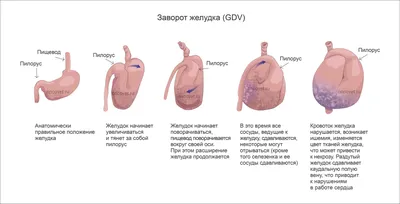 Вода глупая и попадает в желудок А вот сироп от кашля очень умный и  попадает прямо в легкие / приколы для даунов :: вода :: смешные картинки  (фото приколы) :: сироп /