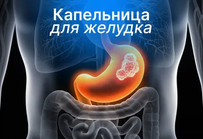 Резекция желудка - что это, для чего нужна, виды, рекомендации врачей