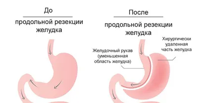 Интересные факты о человеческом желудке