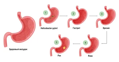 Болит желудок - диагностика и методы лечения