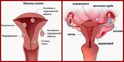 Женские болезни: какие бывают, симптомы, диагностика и лечение | ЭКО-блог