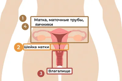 Женское здоровье (гинекологические заболевания): часто задаваемые вопросы |  Клиника Эксперт