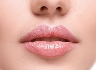 Клиника Медлайн - Сегодня поговорим о губах💋 Женские губы... | Facebook