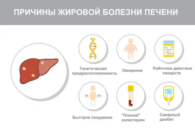 Жировой гепатоз (стеатоз печени) лечение консультация в экспертной клинике  ID-CLINIC Санкт-Петербург