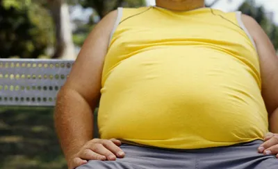 Большой живот опаснее, чем ожирение - Национальная бариатрическая практика