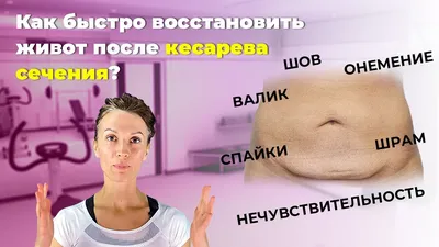 Как избавиться от живота после кесарева сечения