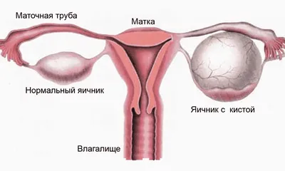 Бариатрия Хирургия Флебология on Instagram: \"Вот так выглядит живот через 4  дня после лапароскопической операции по поводу грыжи (фото в галерее). ❗️В  отличие от полостной операции, вместо разреза остается всего несколько  небольших