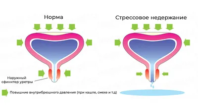 Пластика влагалища — лечение по выгодным ценам Доктор Титов Денис Сергеевич