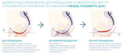 Что такое интимная пластика? - Самченко Людмила Борисовна