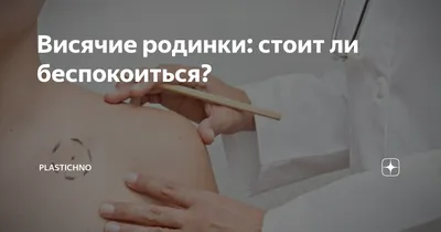 Висячие родинки на шее и под мышками: причины появления и способы удаления