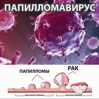 Рак полости рта: симптомы, признаки, лечение, прогноз