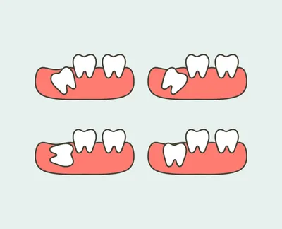 Потемнение молочных зубов - SHiFA