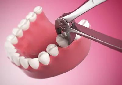 Строение и заболевания зубов