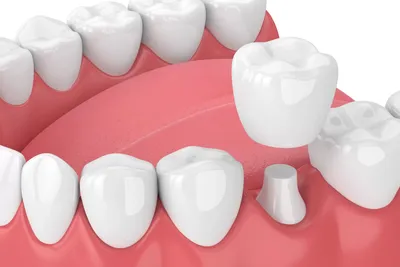 Как здоровье зубов влияет на сердечно-сосудистую систему