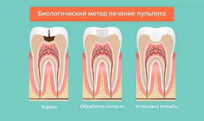 Зуб потемнел, почему?