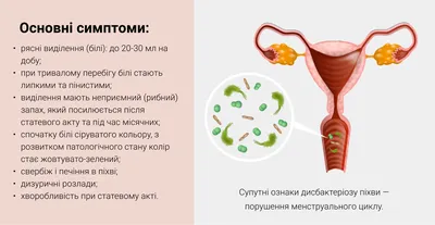 Вагинит (кольпит) симптомы, причины и лечение в Ростове-на-Дону